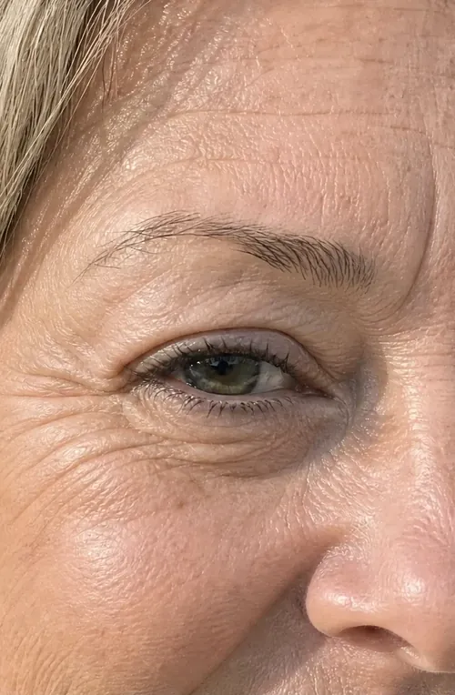 Close-up of fine lines near the eye